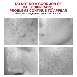 Kina Billig pris ODM/OEM Anti Age Black Spots Whitening Firming Face Cream 100% Natural