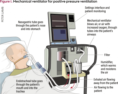 Återanvändbar pediatrisk-vuxen utandande syrgaschoke Filter i den mekaniska invasiva ventilatorn