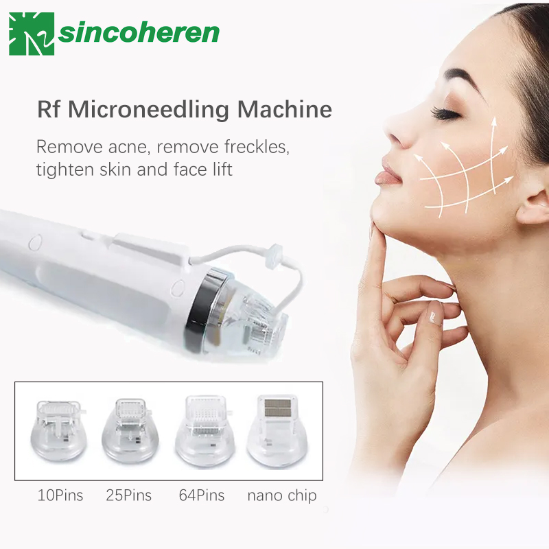How many times can you do RF microneedling?