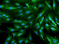 Pob txha Cells Fluorescence Imaging