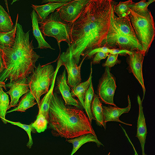 Fluorescence microscopy-BPAE Cells