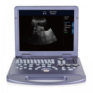 Low MOQ for Hand Held Echo Machine - DW-360 laptop black and white ultrasound machine price – Dawei
