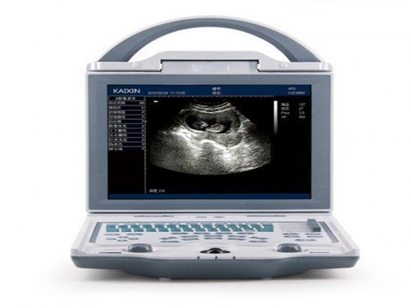 Prenosný ultrazvukový prístroj