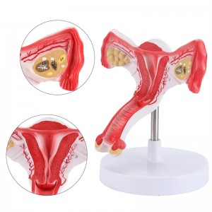 Modelo anatômico de útero feminino com ovário