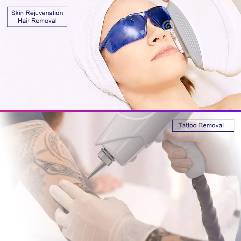 2in1 Q Switch ND YAG Tattoo Removal IPL Hair Removal Laser