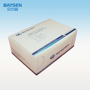 Factory best selling China One Step Test Kits Procalcitonin (PCT)