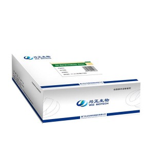 Factory source Hiv Diagnostic Rapid Test Kits - Diagnostic Kit (Colloidal Gold) for Dengue NS1 Antigen – Baysen