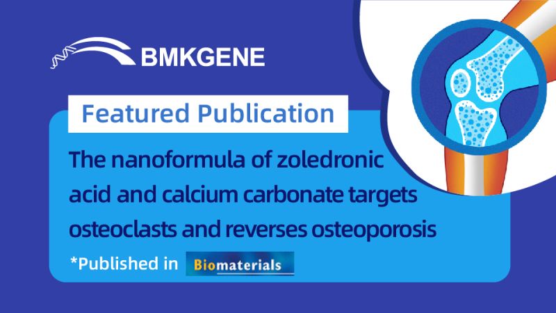 Featured Publication-De nanoformule fan zoledronsäure en kalsiumkarbonaat is rjochte op osteoklasten en reverseart osteoporose