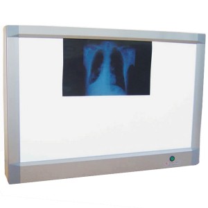 Visor de películas de raios X LED