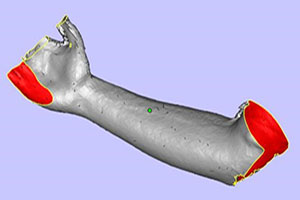 Modelo médico de impresión 3D