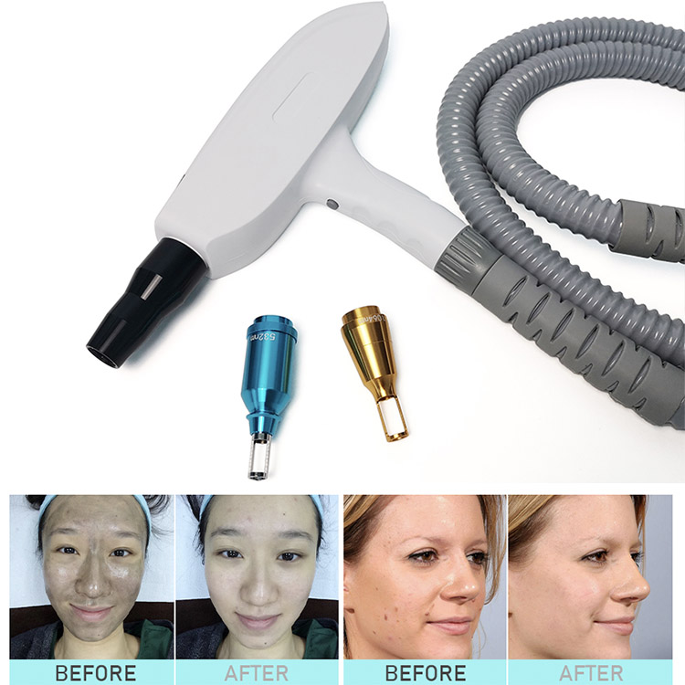 new design PICOLASER vertical 532nm 1064nm 1320nm for Pigment Removal,Tattoo Removal