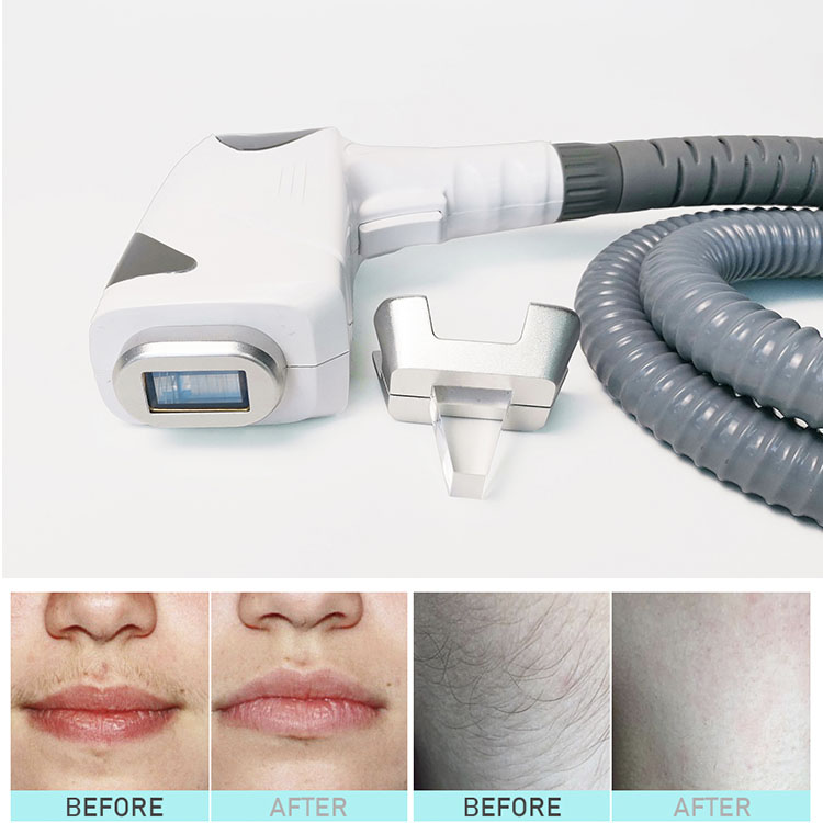 Diode Laser+ND YAG tattoo removal +980nm 3 in 1 Laser Beauty Machine