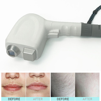 Multifunctional Laser opt shr ipl RF Laser Hair Removal Skin Treatment