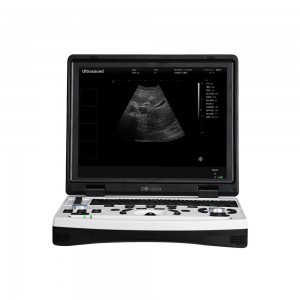 Instrumento de diagnóstico de ultrassom veterinário digital completo para laptop 690-VET
