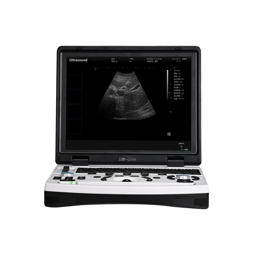 690-VET Laptop Full Digital Veterinary Ultrasound Diagnostic Instrument Featured Image