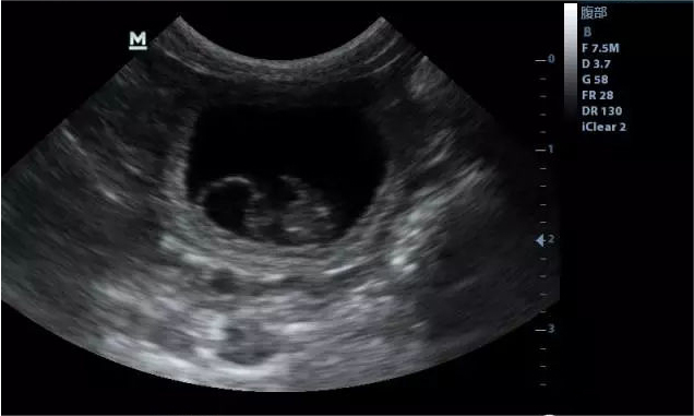 Imagem ultrassonográfica do útero em cães