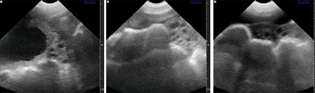 Exame ultrassonográfico de ovários de porcas por ultrassom suíno