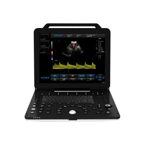 New Launch Portable Veterinary Color Doppler Ultrasonic Diagnosic System