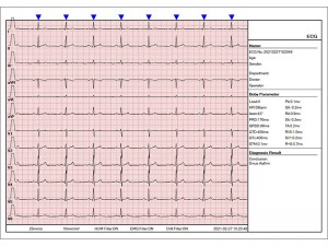 Veteriner Kullanımına Yönelik 12 Kanallı EKG Makinesi