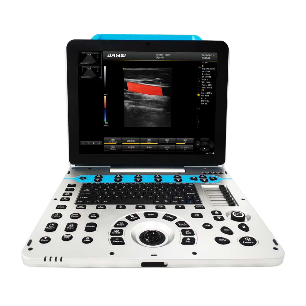 Portable Color Doppler Veterinarian Ultrasound System P3-VET Featured Image