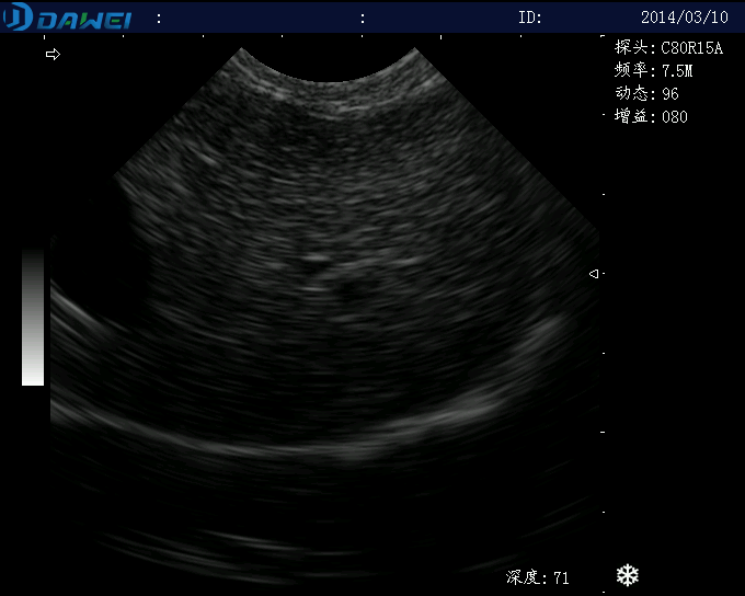 Exploração ultrassonográfica de fígado, baço e pâncreas em pequenos animais