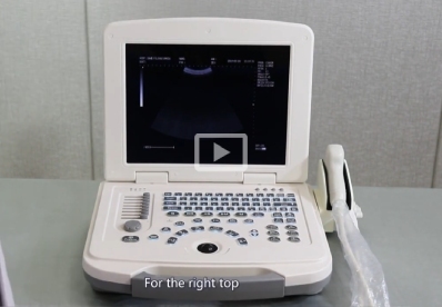 Laptop BW Ultrasound MU12