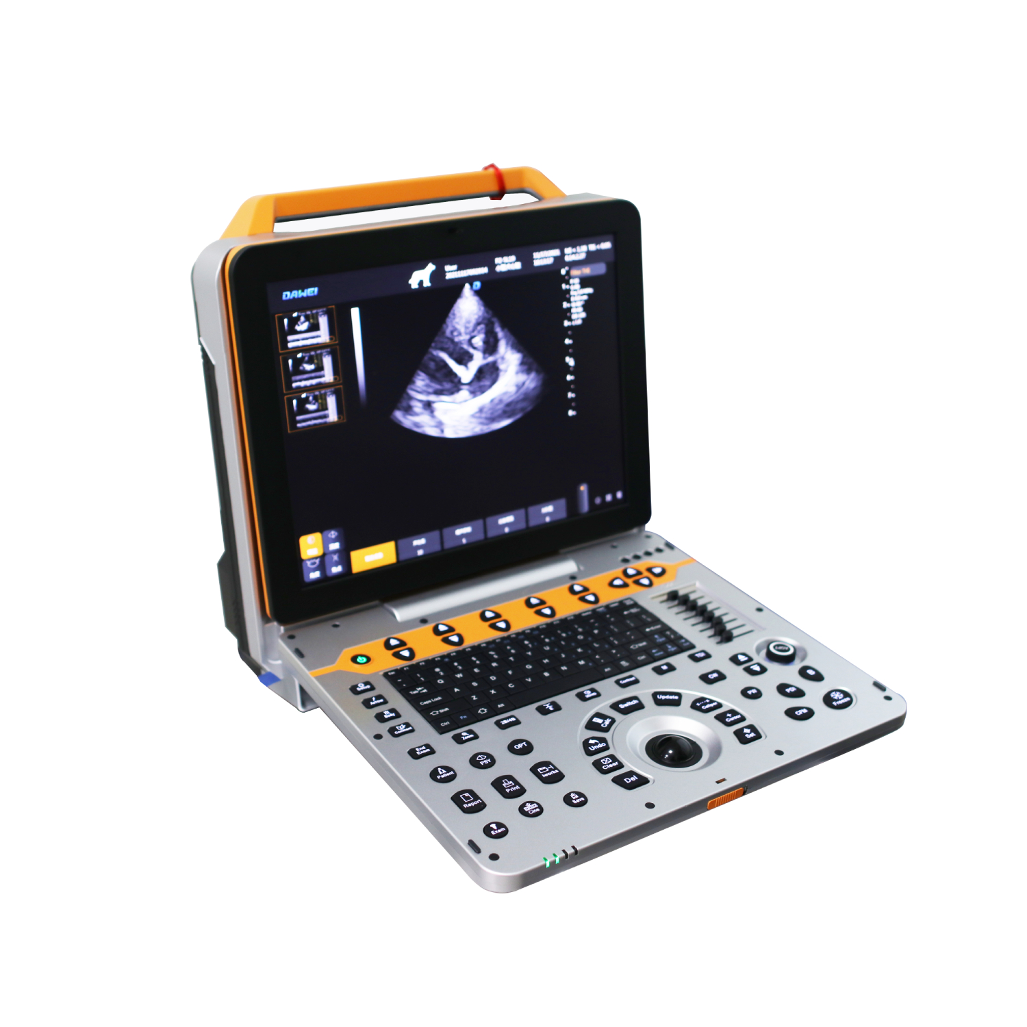 P50-VET Spectral Doppler Imaging Speckle Reduce Imaging Ultrasonic System Featured Image