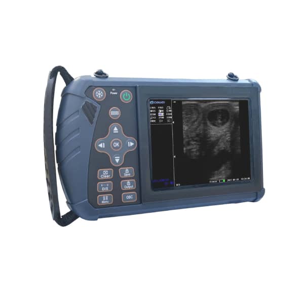 scanner de ultrassom portátil-1-tuya