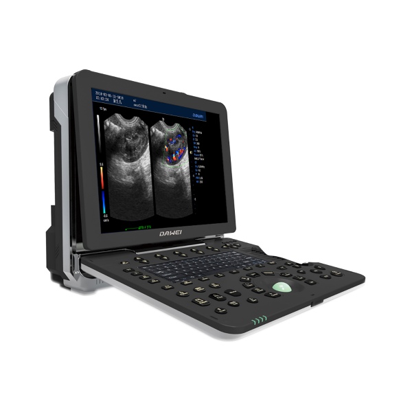 High-End Portable Veterinary Color Doppler Ultrasonic System Featured Image