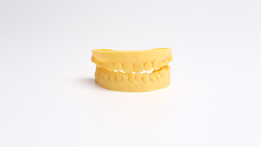 Dental Model Resin_Print model_1