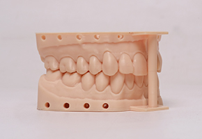 Galeria de resina modelo de restauração dentária DM100
