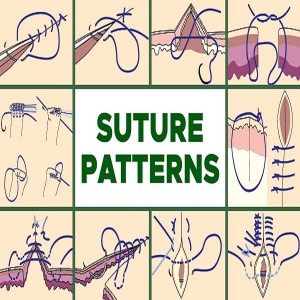 Patrons de sutura comuns (2)