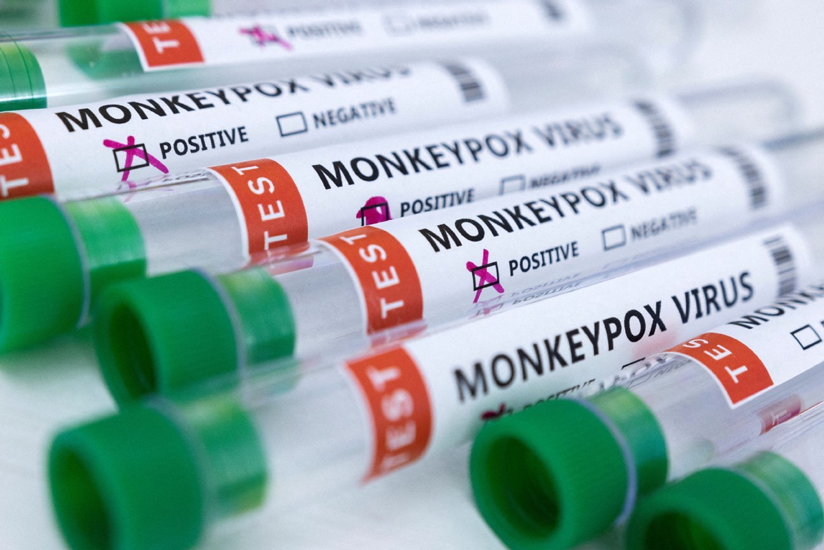 WHO กล่าวว่าการแพร่กระจายของ Monkeypox อาจเกิดขึ้นได้