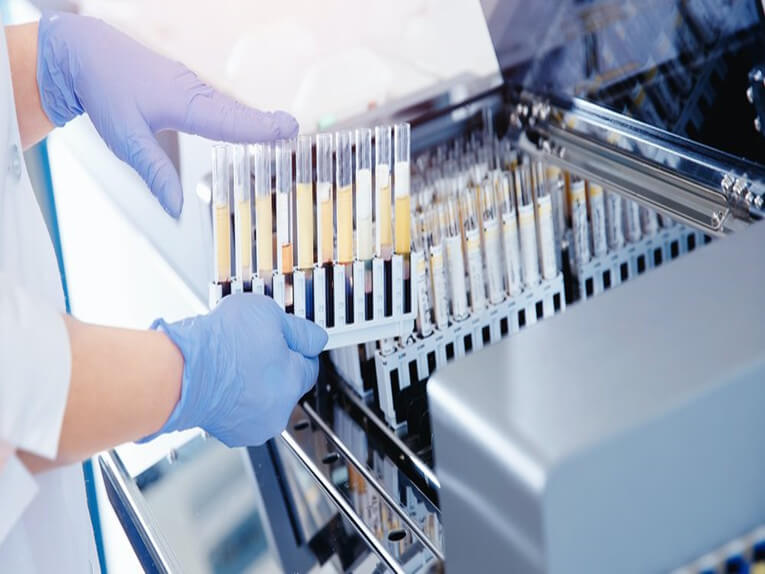 Lineaariset liikejärjestelmät lääketieteellisten sovellusten automaattisessa RT-PCR-testauksessa