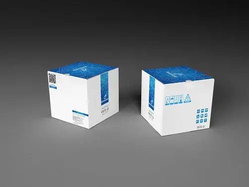 Ar žinote, kaip pagerinti spalvotų dėžučių spausdinimo kokybę?