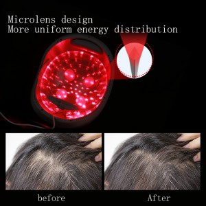 LESCOLTON hårvekstsystem, FDA-godkjent – ​​56 Medical Grade Laser