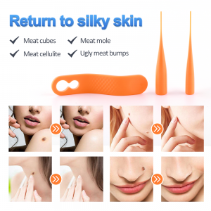 LS-D822 Skin Mole Wart Remover Kit With Cleansing Swabs Adult Mole Wart Face Care Ho Tlosoa ha Letlalo la Letlalo