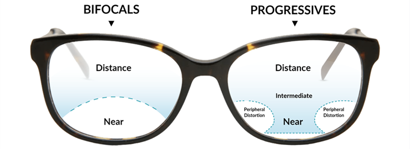 Bifocals VS Progressives, რომელია საუკეთესო პრესბიოპიისთვის?