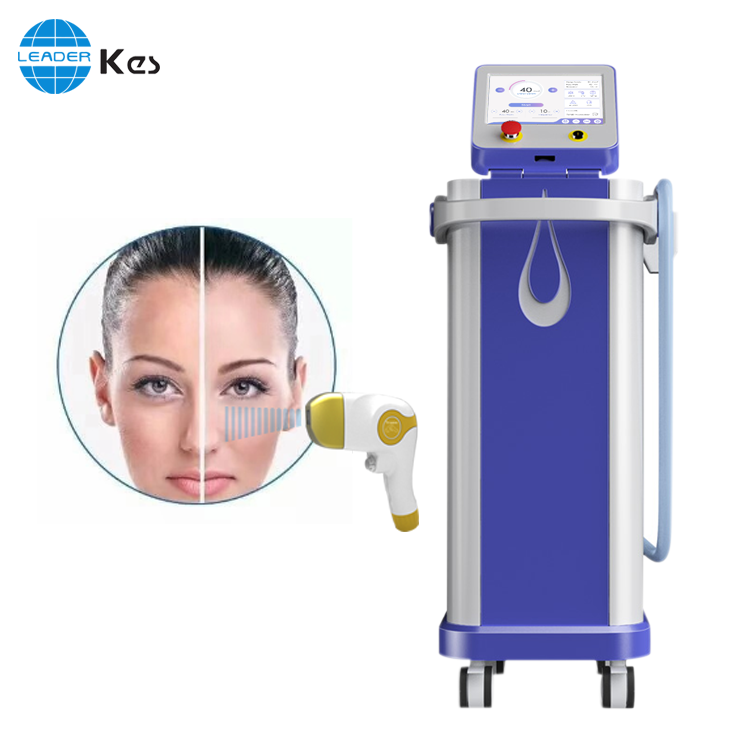 soprano ice hair removal Featured Image
