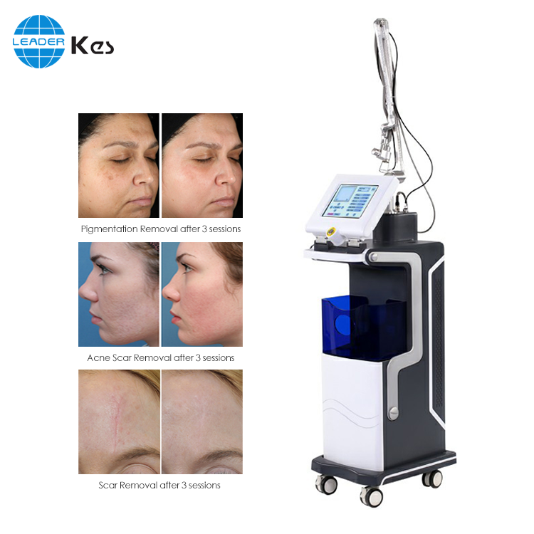 Medical CE Approved Fractional CO2 Laser Vaginal Tightening Machine