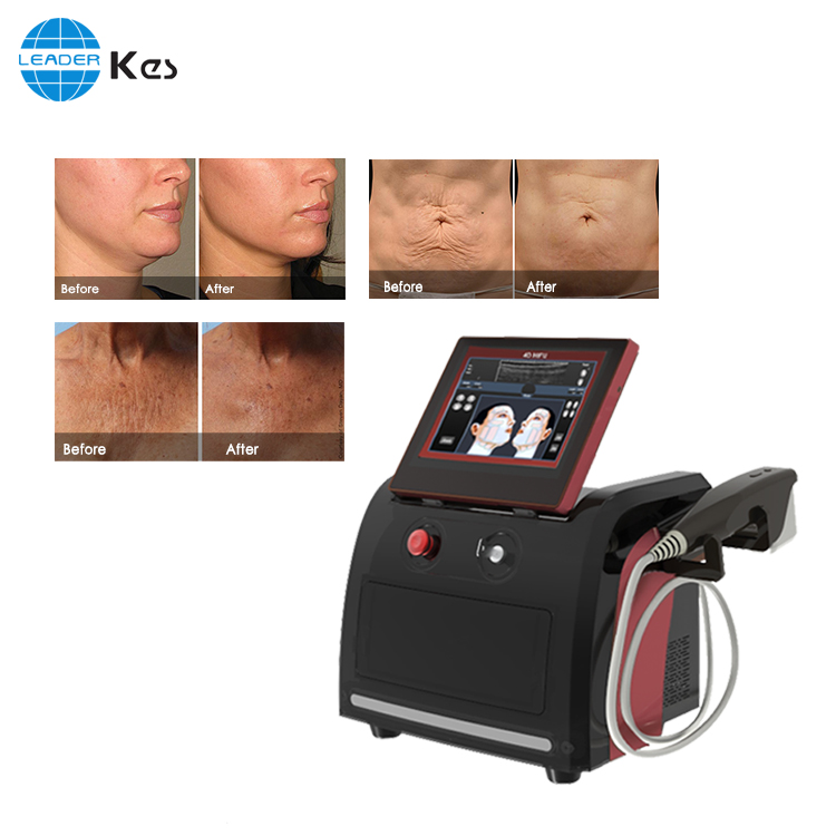 7D Face lifting wrinkle removal 11lines  HIFU machine Featured Image