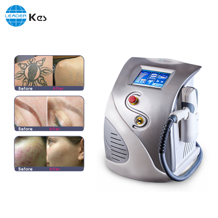 Beijing KES portable nd yag laser tattoo removal machine