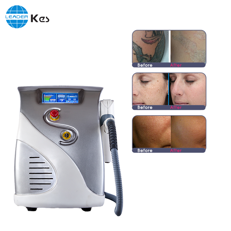 Portable laser tattoo removal equipment