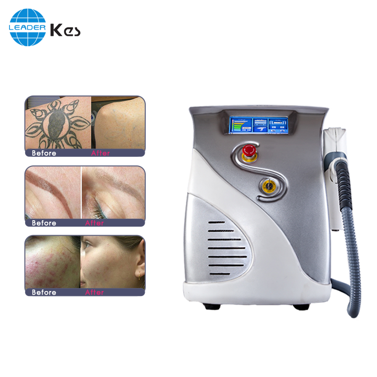 Q Swiched nd yag laser tattoo removal spot removal machine