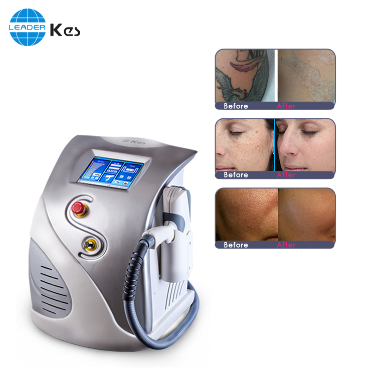 China Wholesale Picoway Machine Cost Manufacturers - Professional Q-Switch Nd: Yag laser tattoo removal machine – KES