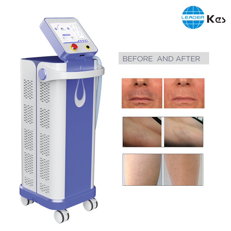 Medical CE hair removal laser cost/fda approved laser hair removal for dark skin