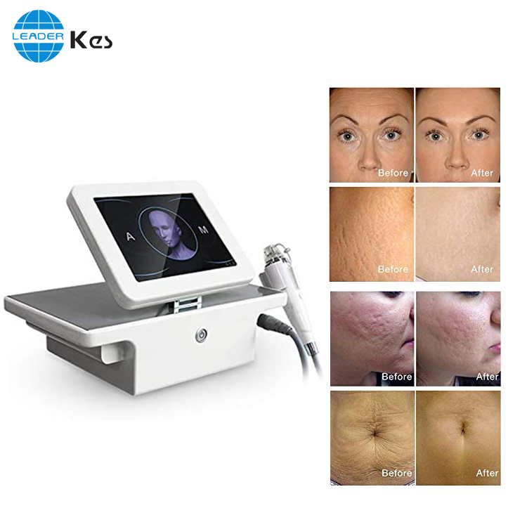 Microneedle Fractional Rf Face Lifting Machine Featured Image