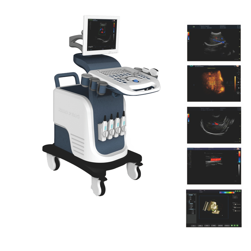 Spalvoto doplerio ultragarso diagnostikos įranga