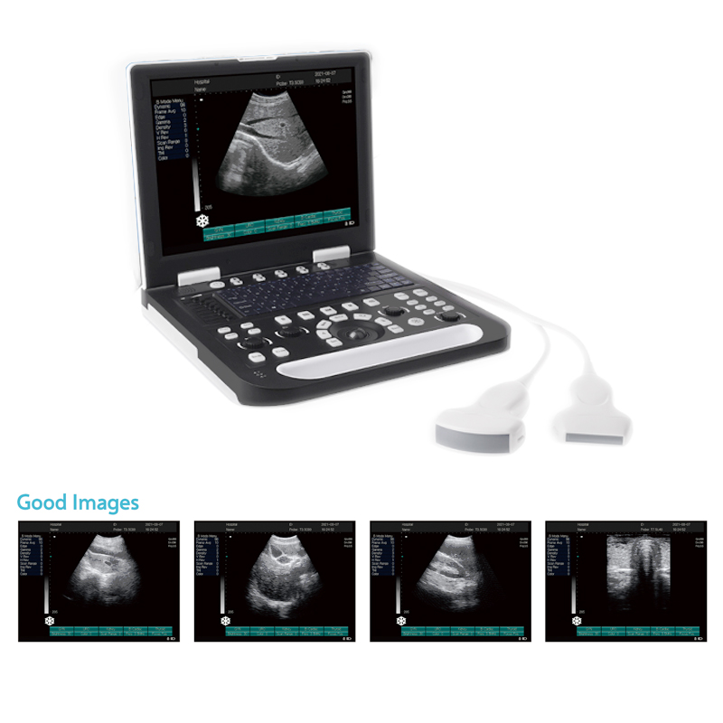 Scanner de ultrassom do Hospital B