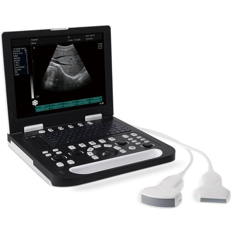 Best Veterinary Stethoscope - Digital B Ultrasound For Veterinary vUlt N50 – Lannx